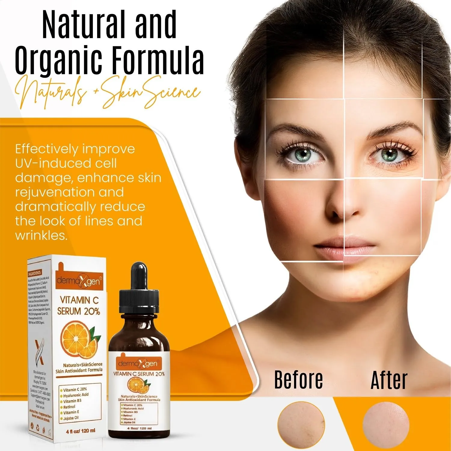 20% Vitamin C Serum   Hyaluronic Acid   Retinol   Vitamin E   Vitamin B PURE ORGANIC- Boost Skin Collagen, Moisturizer, Anti Aging & Wrinkle Facial Serum