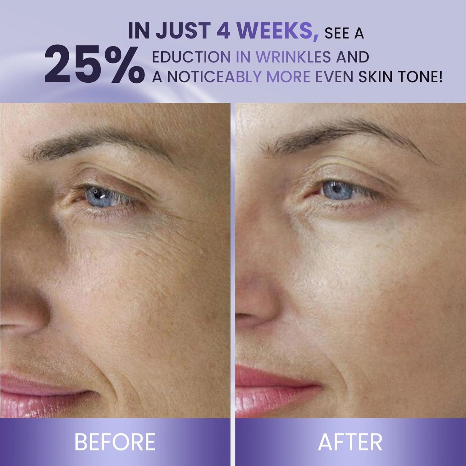 ABERA BELANI Retinol Night Cream For Women, Dark Spot Remover, Melasma Treatment, Reduce Fine Lines, Anti-Wrinkle, Anti-Aging Neck and Décolleté For Face (3 Box   Gift Eyelash Serum)