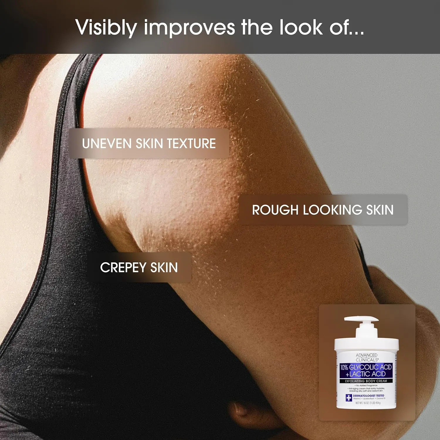 Advanced Clinicals Retinol Body Cream Moisturizer   Exfoliating 10% Glycolic Acid & Lactic Acid Lotion 2PC Skincare Set For Women & Men To Reduce Appearance Of Crepey Skin & Uneven Rough Skin Texture