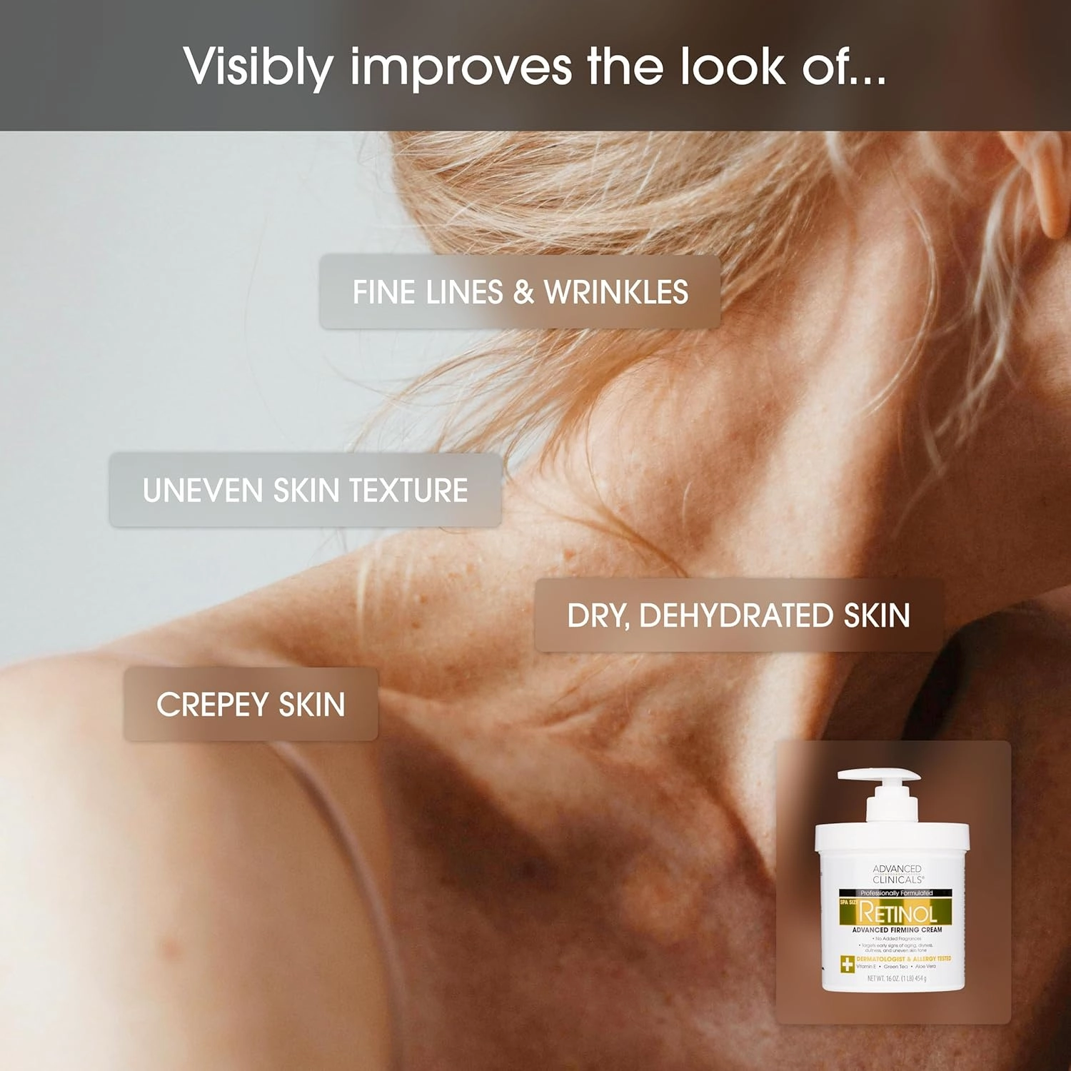 Advanced Clinicals Retinol Body Lotion   Retinol Serum 2PC Skincare Set For Women & Men Helps Diminish Appearance Of Crepey Skin | Face Serum & Body Cream Visibly Improves Look Of Wrinkles & Sagging