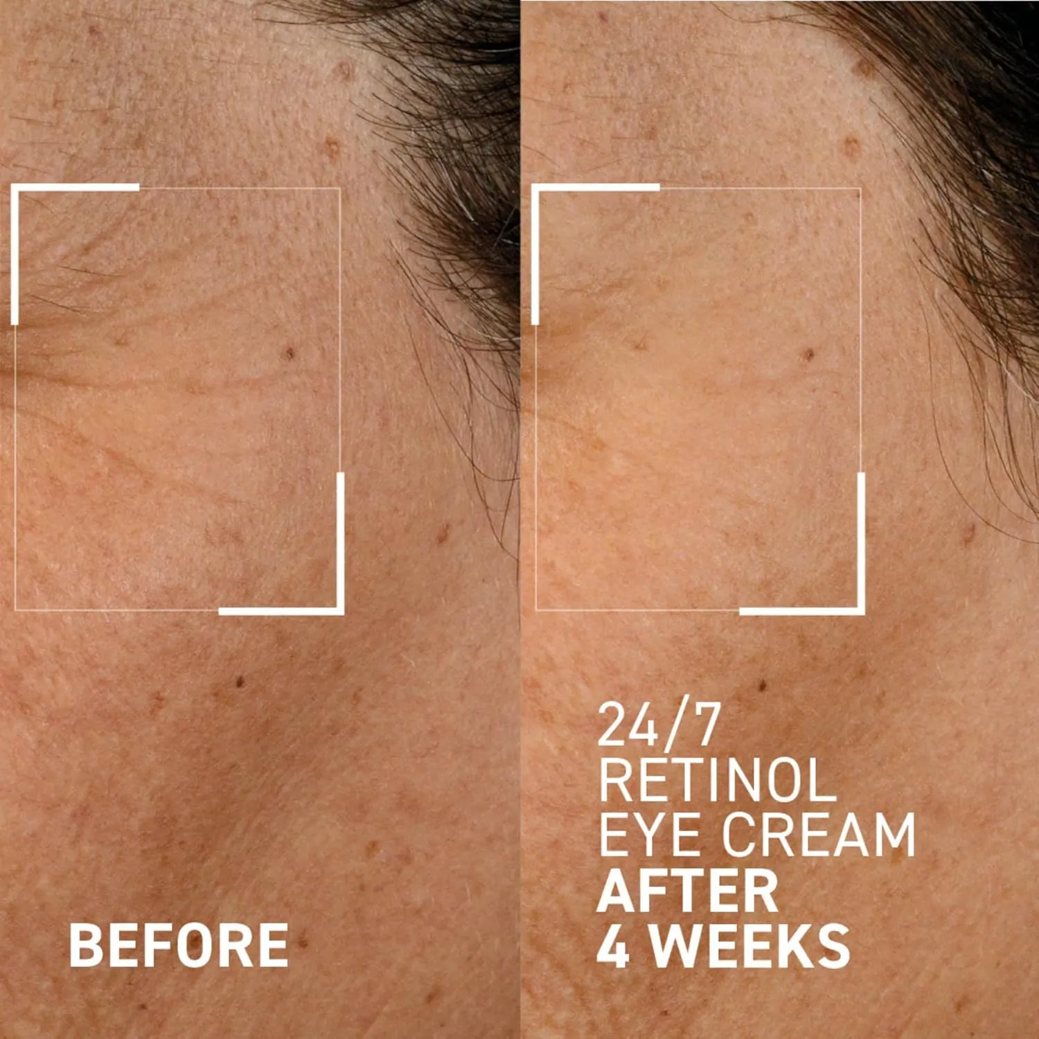 Dr. Brandt Bright This Way 24/7 Retinol Eye Cream - Smooths the Look of Fine Lines & Wrinkles, Illuminates & Moisturizes the Eye Area - 0.5 oz