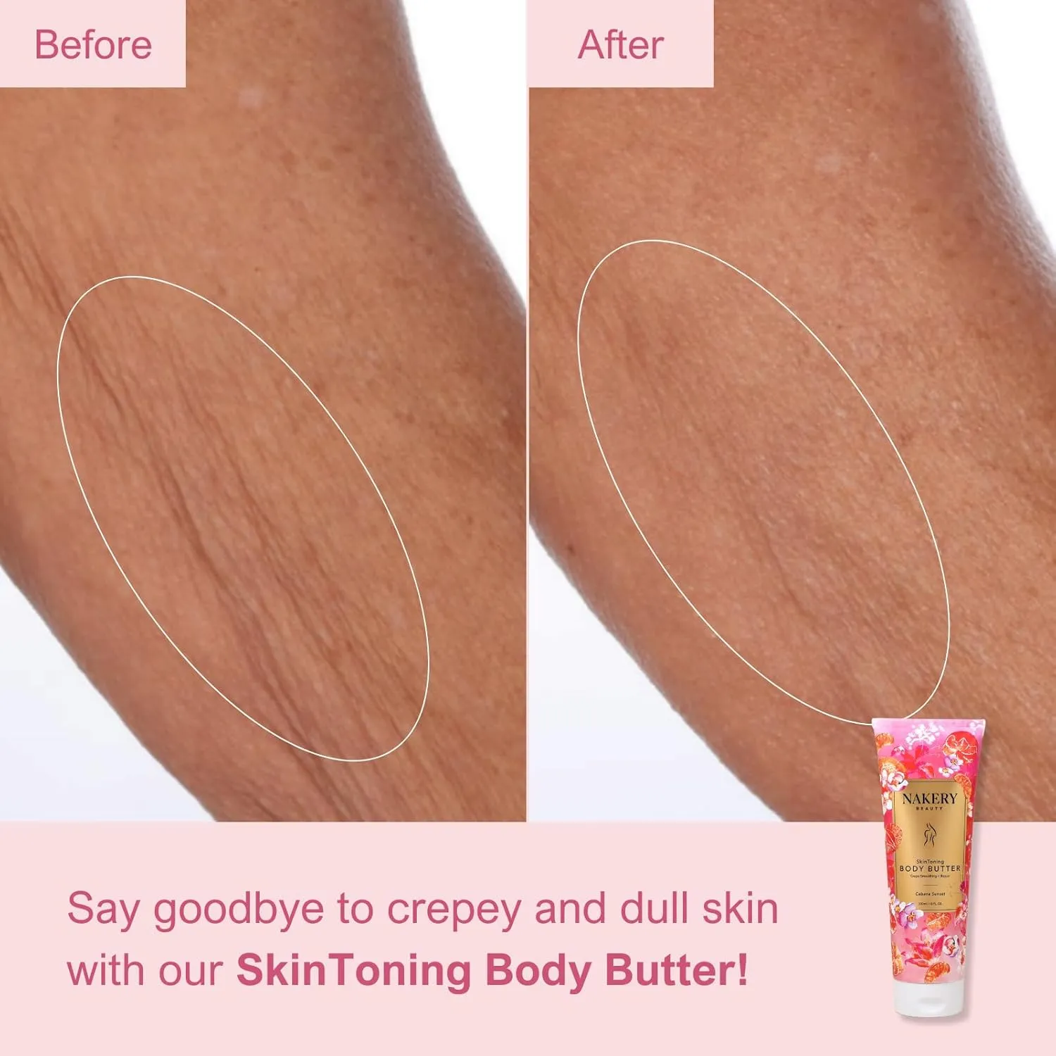 Nakery Skin Toning Body Butter for Women - Firming Body Lotion for Women - Peptide Infused Body Lotion for Crepey & Sagging Skin - Skin Firming Lotion for Neck, Arms & Legs - Cabana Sunset