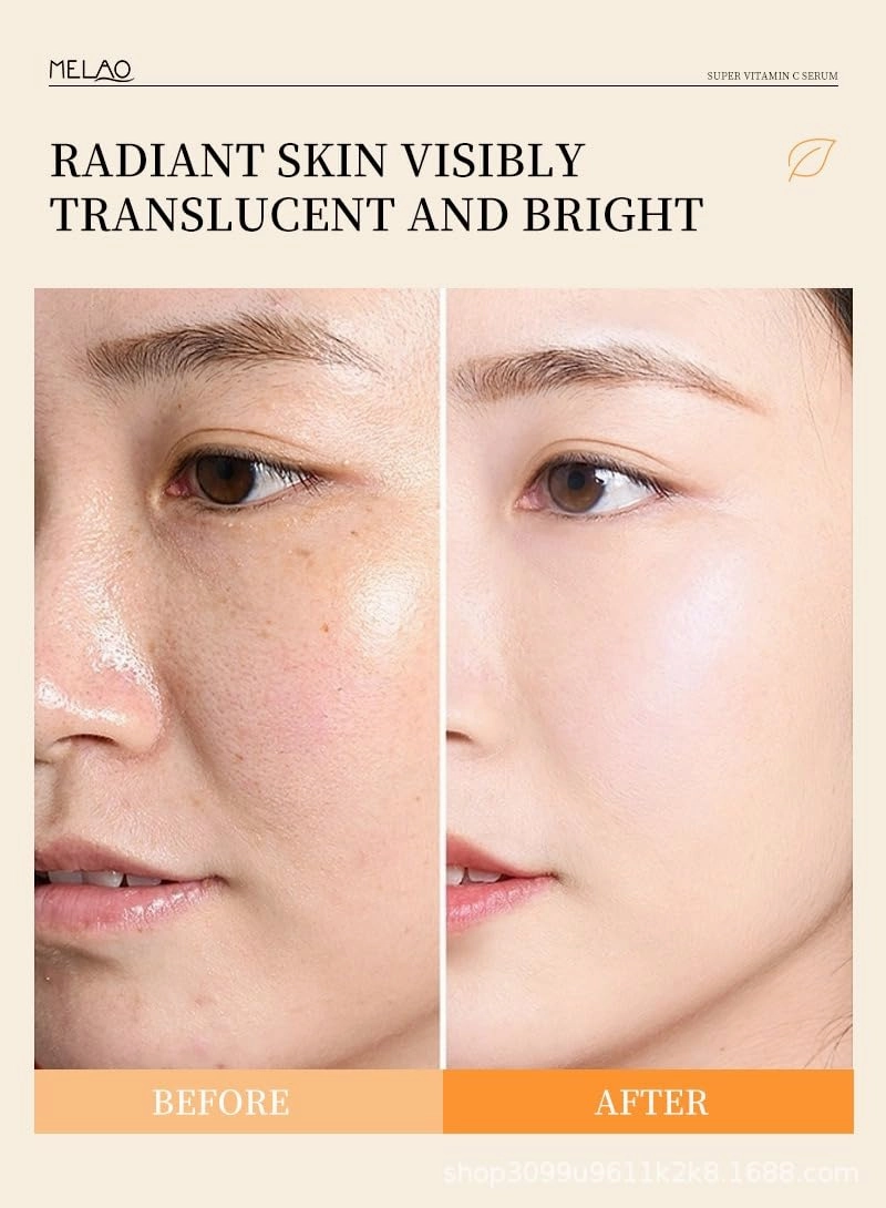 Vitamin C Super Face Serum, 30ml, with Retinol, Niacinamide and Hyaluronic Acid